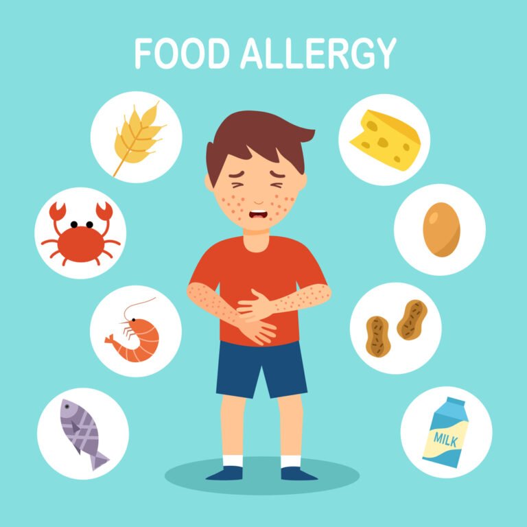 Allergen Awareness Course for Coffee Shop Staff